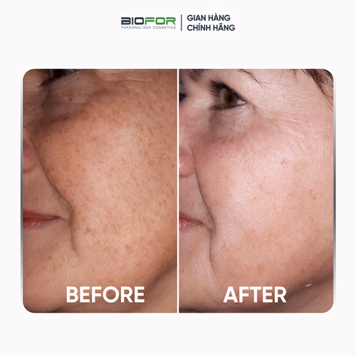 BEFORE - AFTER (1).png